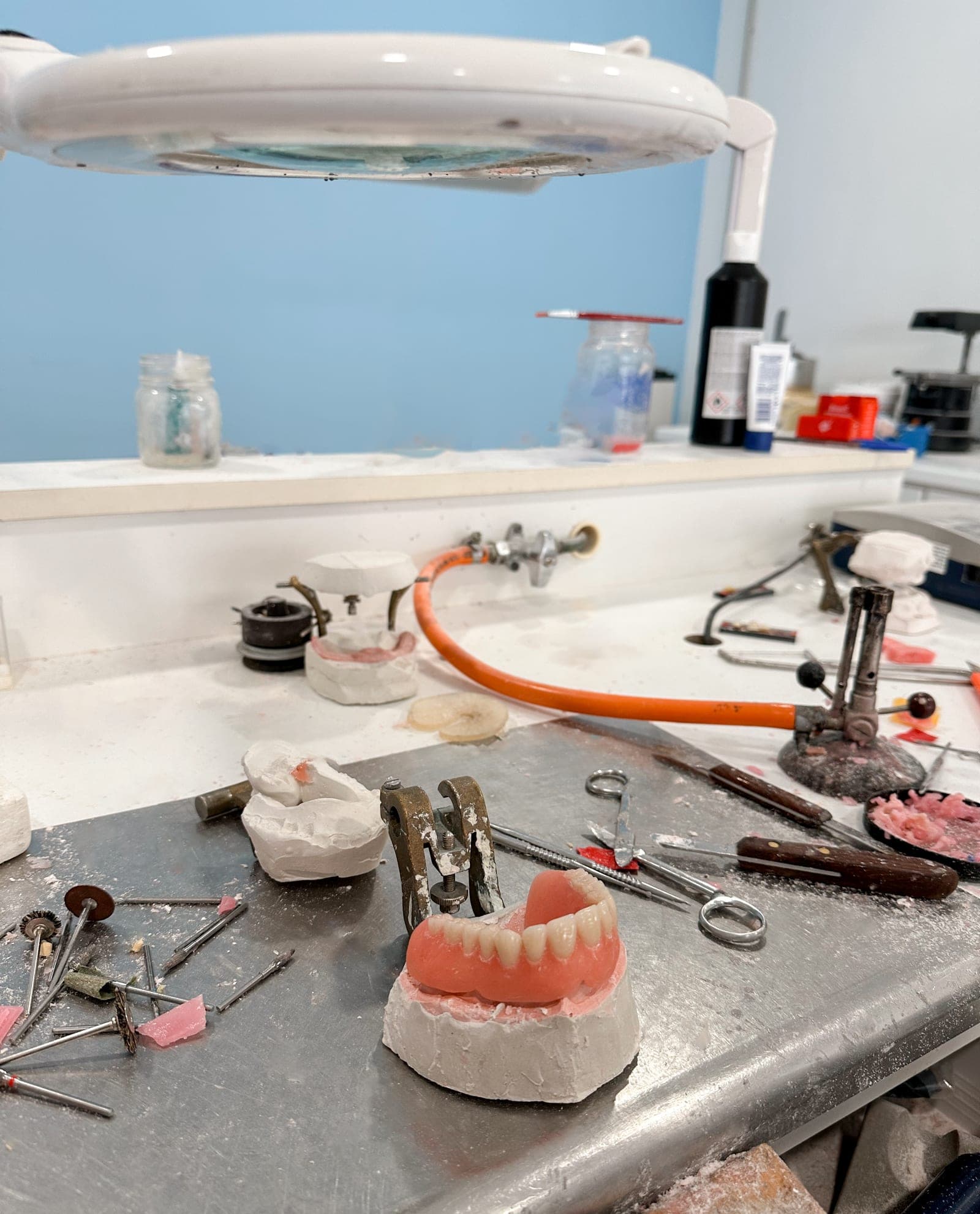 Same-day denture repair — cracked base restored to full strength