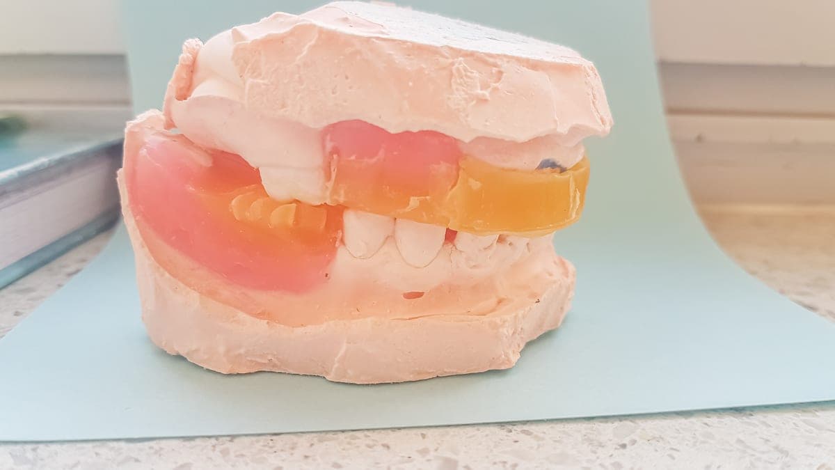 Immediate Dentures